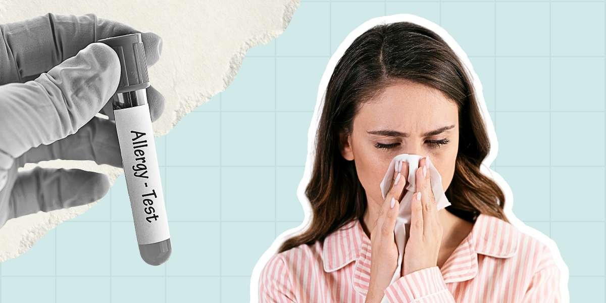 Фото статті Алергопанелі