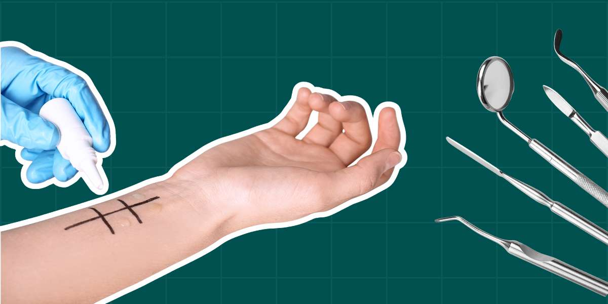 Фото статті Стоматологічні алергопроби: як це працює?