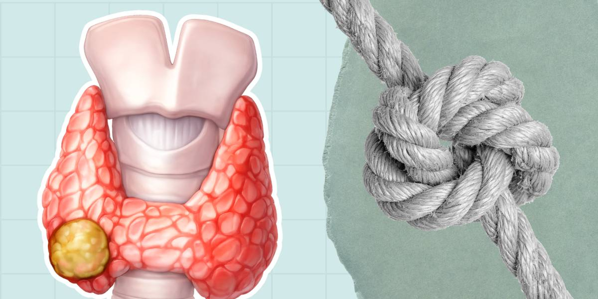 Фото статті Вузли щитоподібної залози: чи небезпечно?