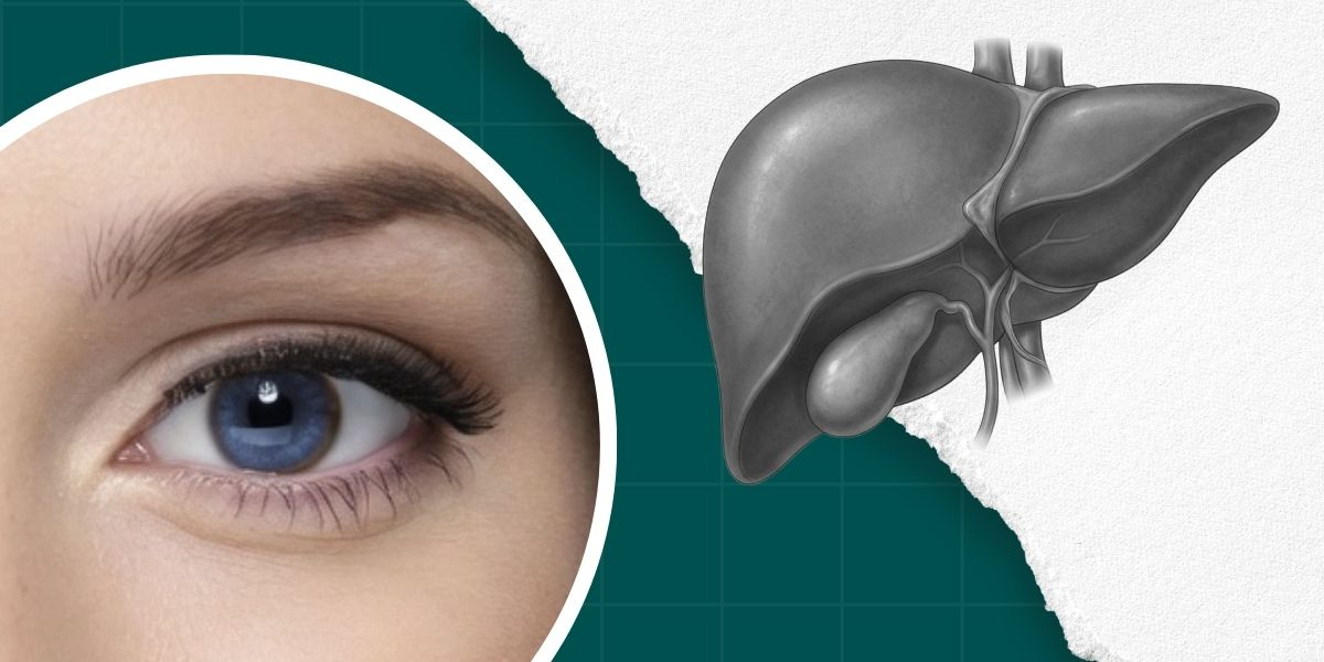 Фото статті Хвороба Вільсона: сучасні можливості діагностики та прогнози