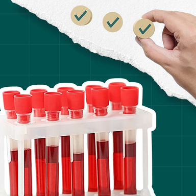 Фото Чому вигідно здавати чекапи у лабораторії Медіс? статті