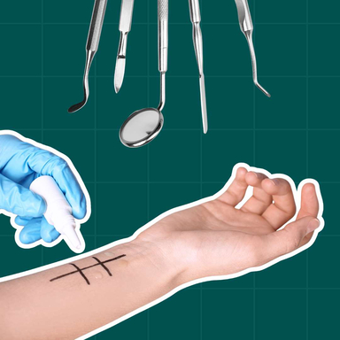 Фото Стоматологічні алергопроби: як це працює? статті