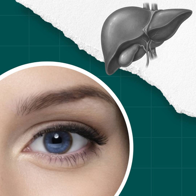 Фото Хвороба Вільсона: сучасні можливості діагностики та прогнози статті