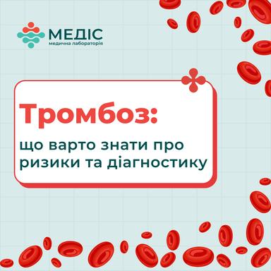 Фото Тромбоз: що варто знати про ризики та діагностику статті