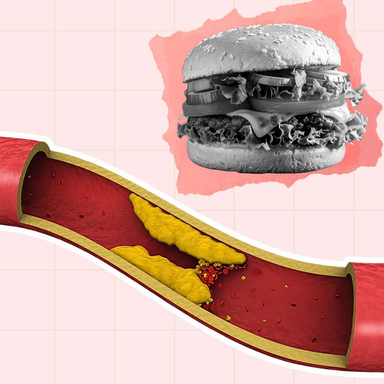 Фото Аналіз крові на холестерин: чому це важливо? статті