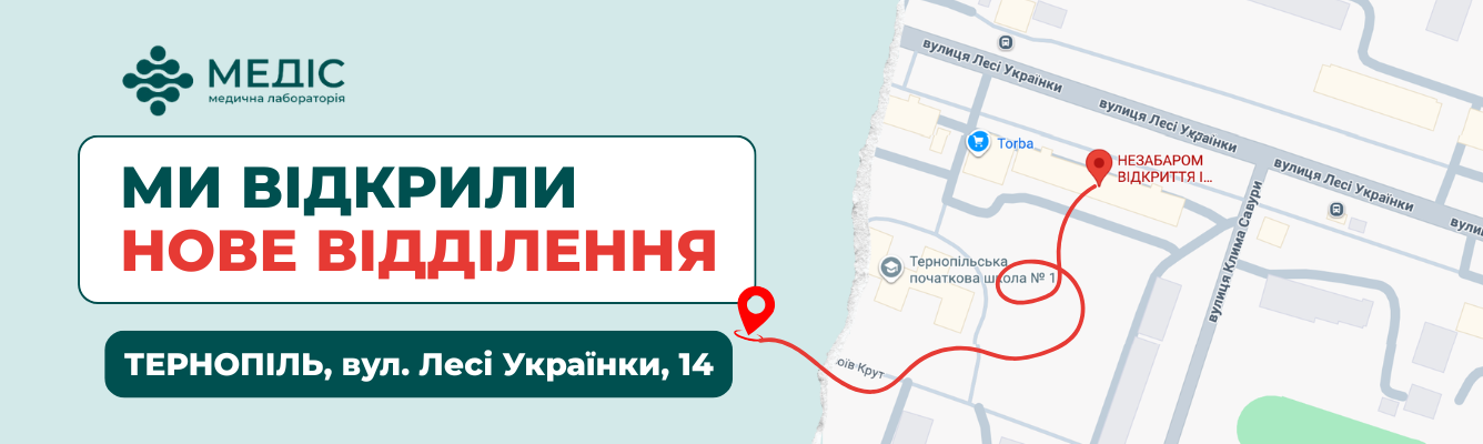 Спеціальна пропозиція в честь відкриття.