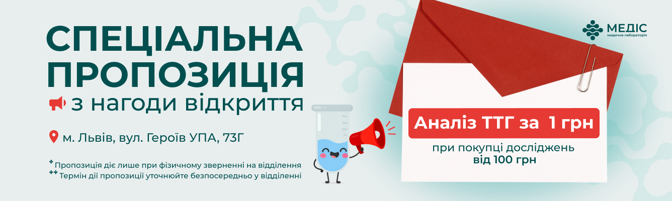 Спеціальна пропозиція в честь відкриття/