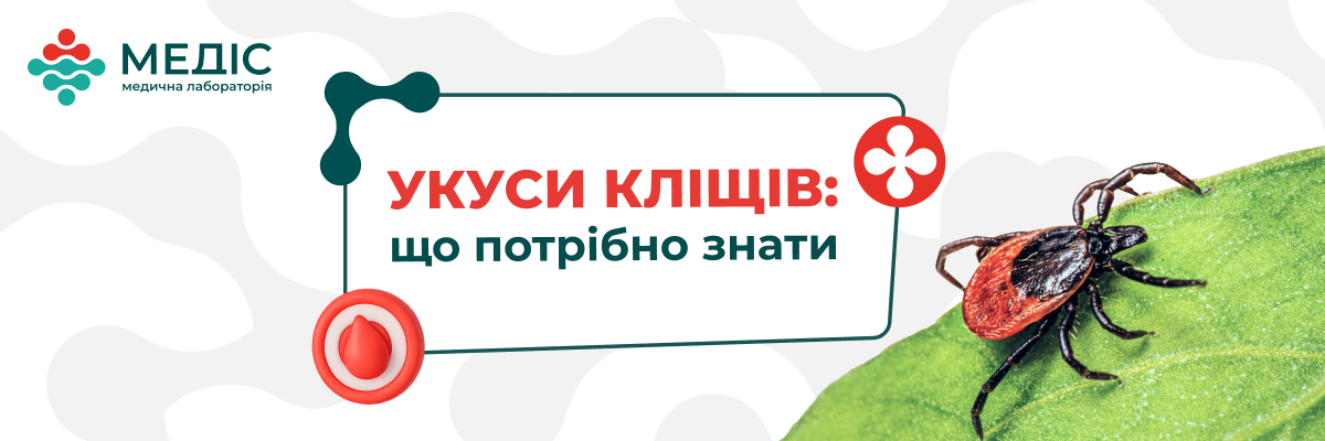 Як тільки температура повітря підвищується до +5°С активізуються кліщі, які можуть становити серйозну небезпеку для здоров’я і навіть життя людини.