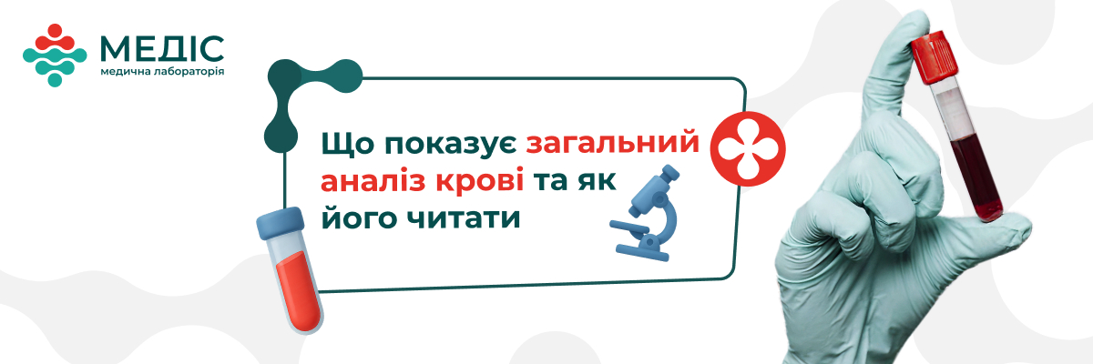 Загальний аналіз крові (ЗАК) — один із найпоширеніших та водночас найінформативніших досліджень для оцінки стану здоров’я.
