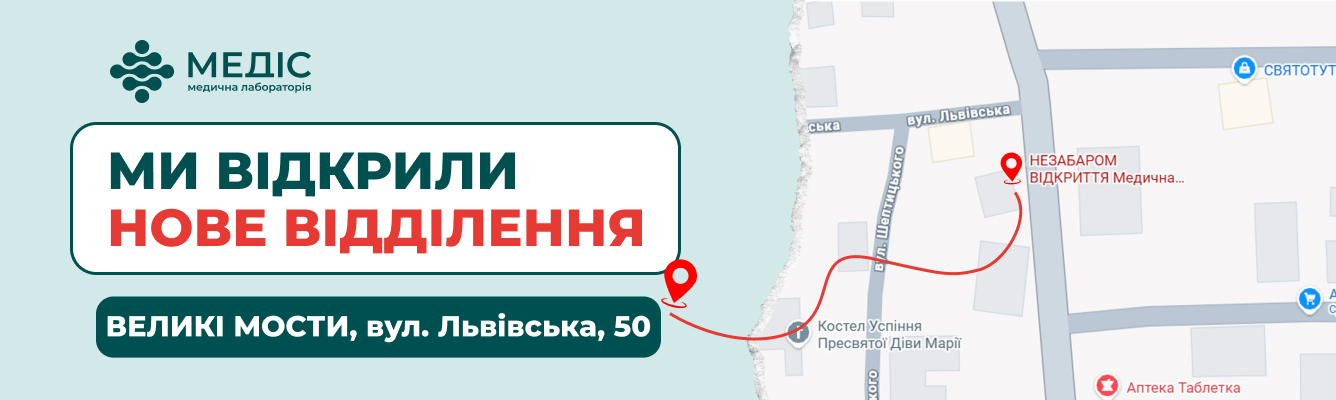 Спеціальна пропозиція в честь відкриття.