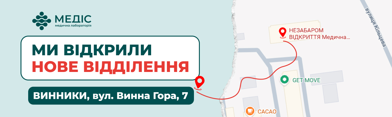 Спеціальна пропозиція в честь відкриття.