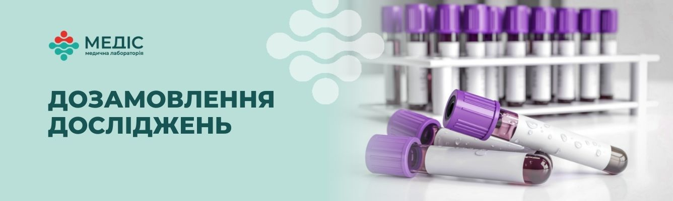 Дозамовляйте необхідні лабораторні дослідження без повторного забору біоматеріалу — швидко, зручно та через Відділ турботи Медіс.