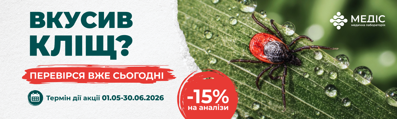 Пропозиція діє у всіх відділеннях лабораторії.