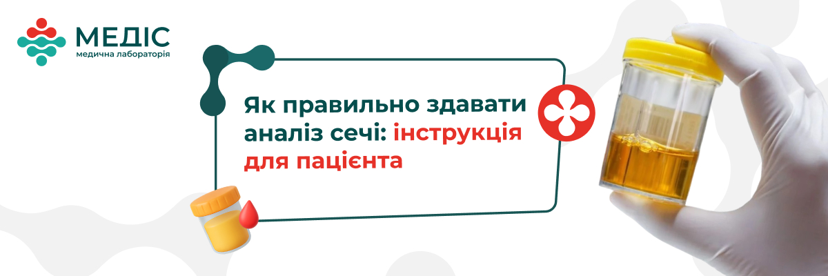 Аналіз сечі — базове, але надзвичайно інформативне лабораторне дослідження, яке дає змогу оцінити функціонування нирок, сечовидільної системи, виявити запальні, інфекційні та метаболічні порушення.