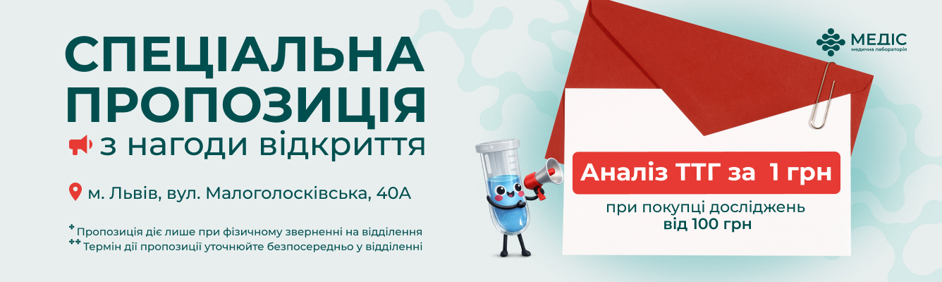 Спеціальна пропозиція в честь відкриття