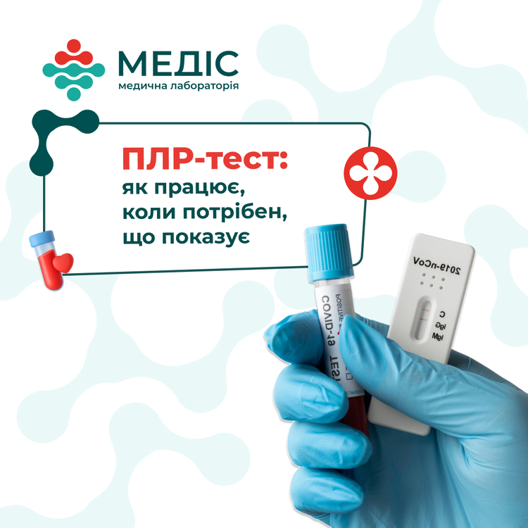 Фото новини ПЛР-тест: як працює, коли потрібен, що показує