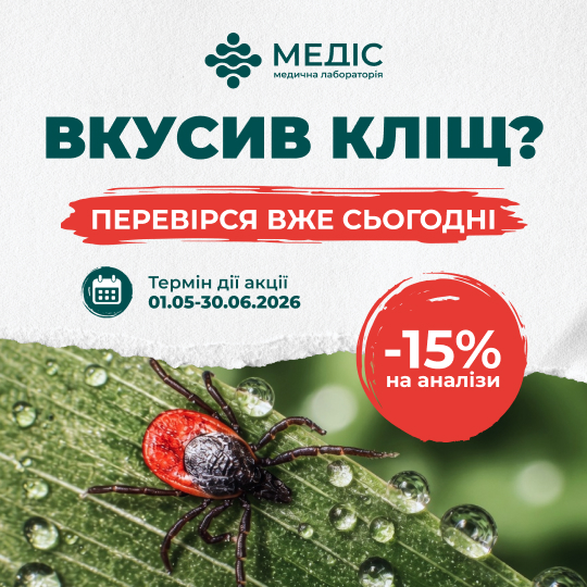 Фото акції Вкусив кліщ? Перевіртесь вже сьогодні