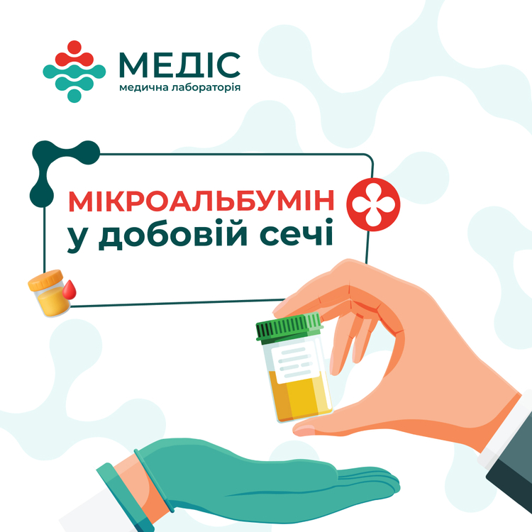 Фото новини Мікроальбумін: чим особливе це дослідження та кому варто його пройти